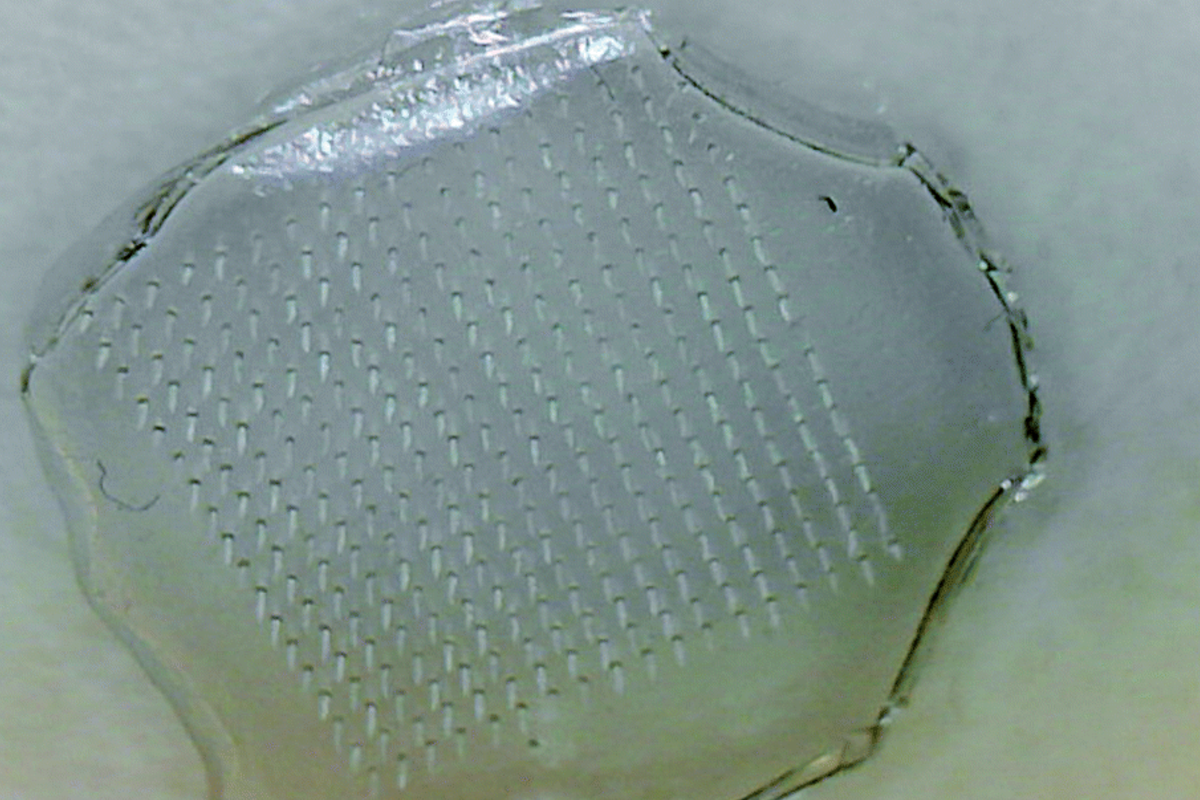 Combatting Food Poisoning with a Patch