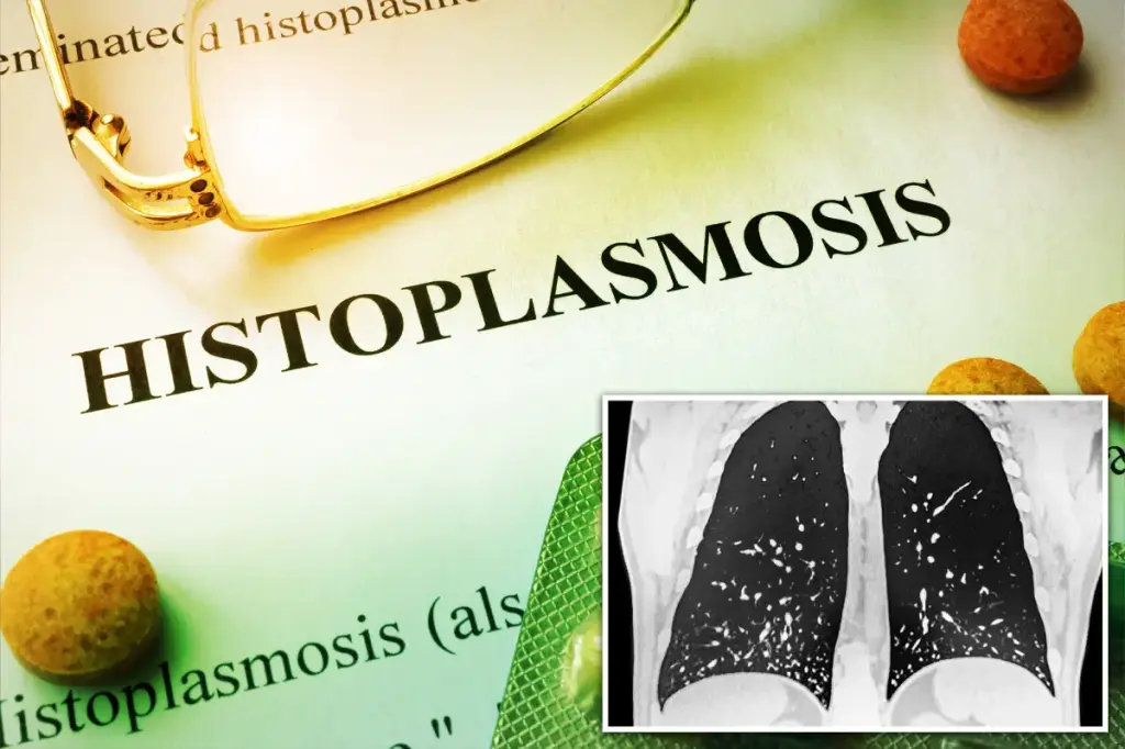 Dangerous fungus makes many people ill as infection spreads throughout Tennessee