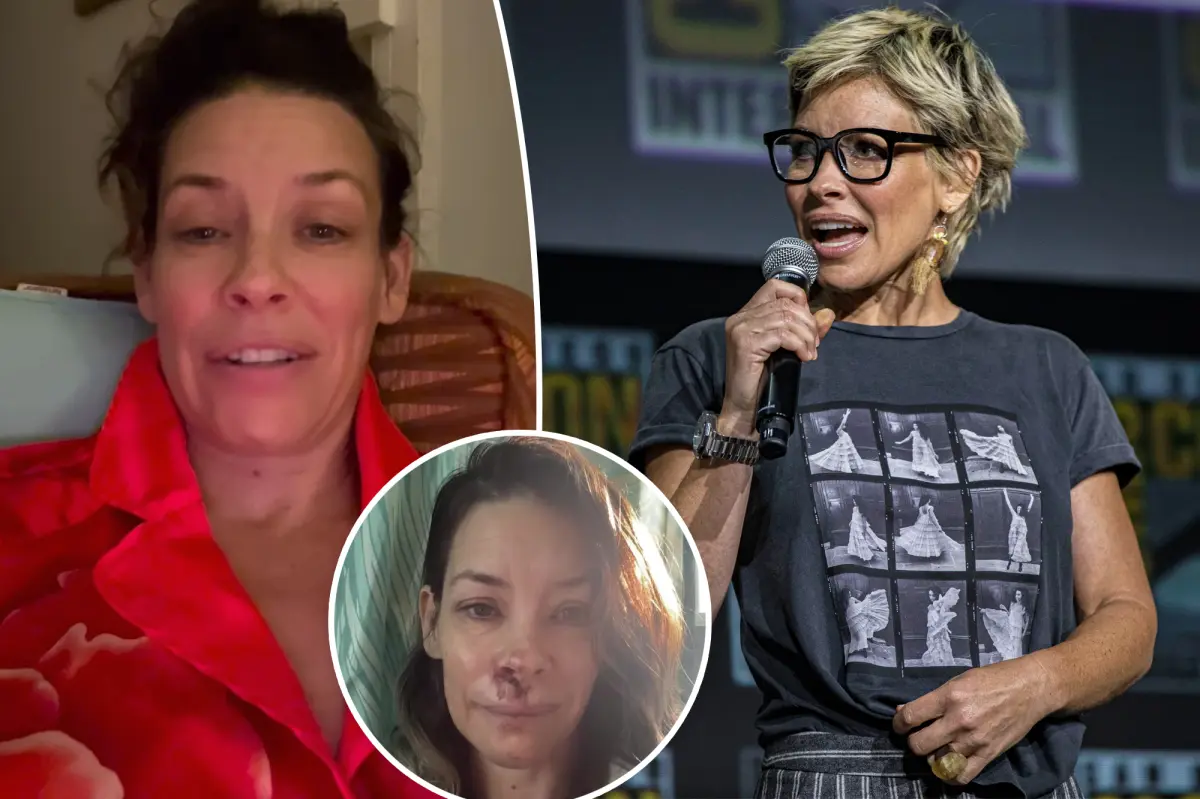 Evangeline Lilly reveals she has a brain injury following an accident