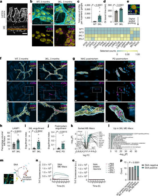 Gut macrophages influence synucleinopathy in the gut-brain connection