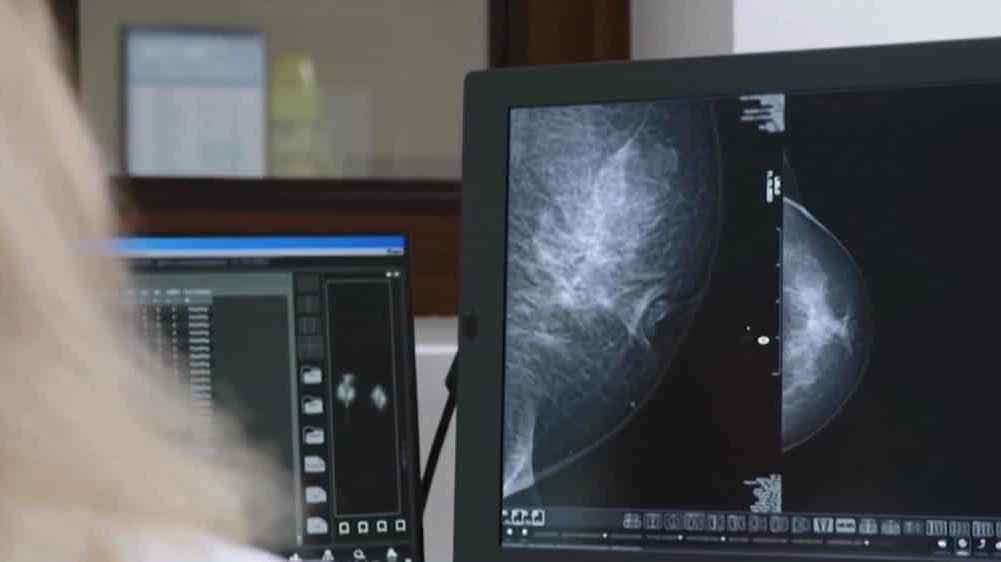 Highmark Health plan members will have complete coverage for diagnostic breast cancer tests and MRIs.