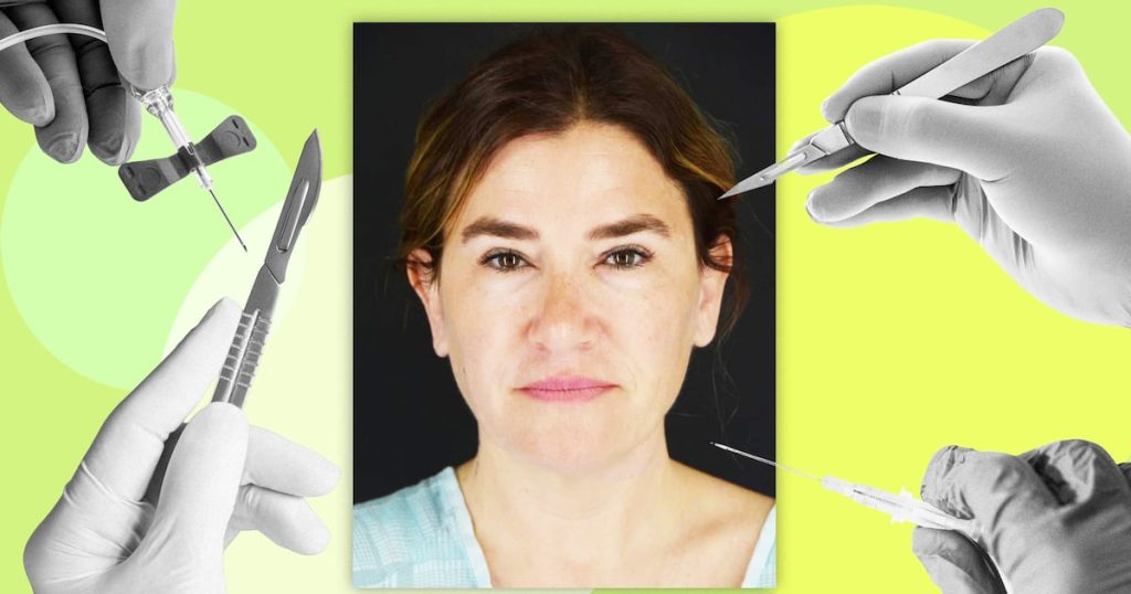 How a Woman in Her Late 40s Achieved Remarkable Results Without Surgery