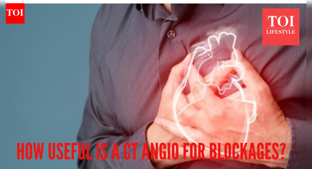 Is a CT Angiography necessary to find heart blockages? Top doctor clears up some misconceptions