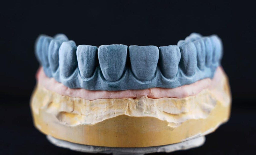 It’s Not About Your Heart or Brain; Your Teeth Show How Long You Might Live