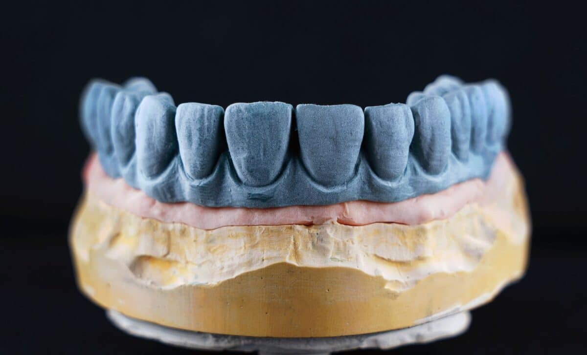 It’s Not About Your Heart or Brain; Your Teeth Show How Long You Might Live