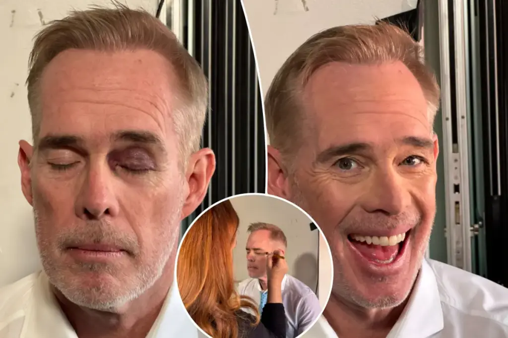 Joe Buck shares about the black eye concealed by an ESPN makeup artist