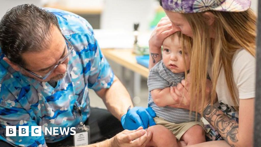 Measles cases rise in South Carolina as the US faces the danger of losing its elimination status