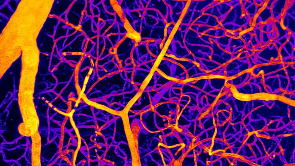 One Molecule Might Shed Light on the Connection Between Brain Blood Flow and Dementia