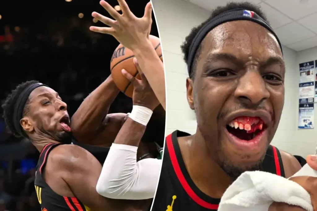 Onyeka Okongwu of the Hawks reveals serious injury from elbow to the face