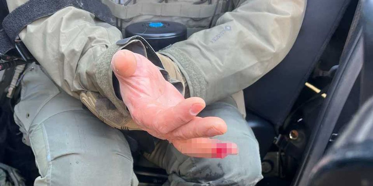 Protester severed section of federal agent's finger during violent incident in Minneapolis, according to DHS.