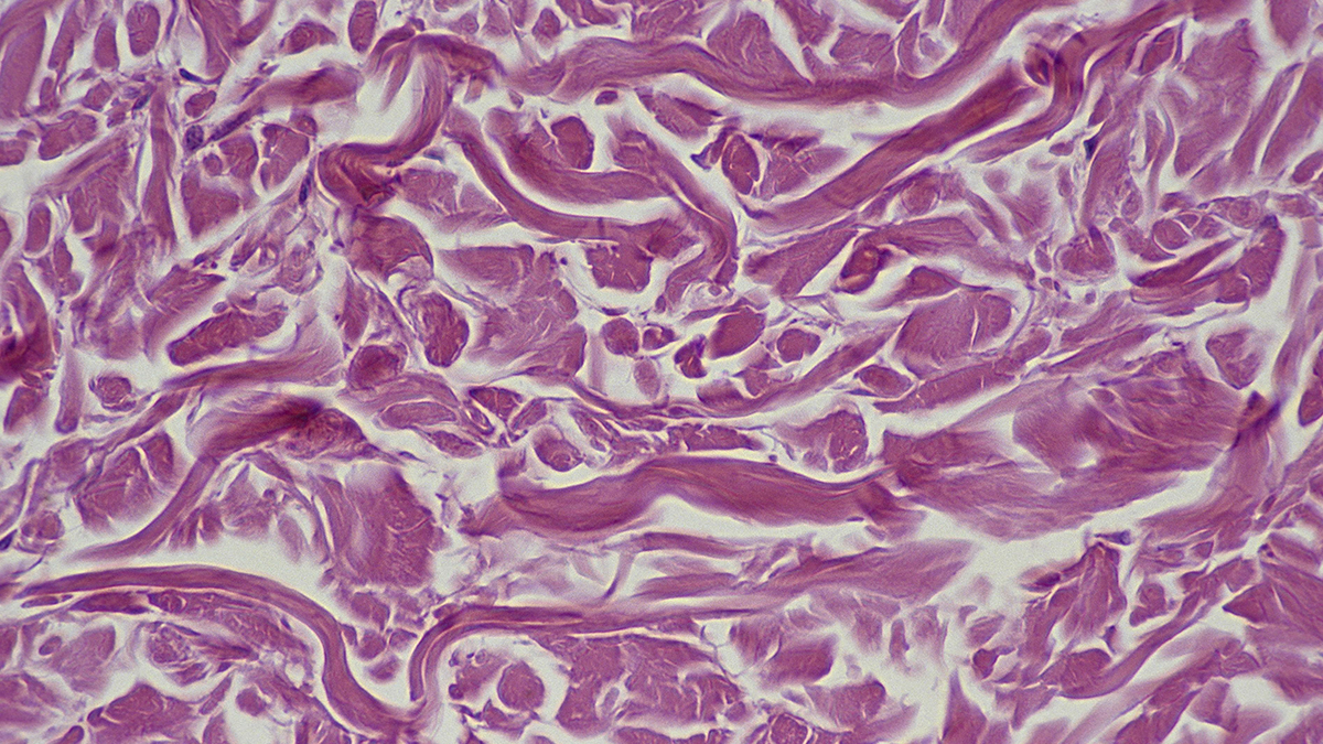 Researchers Might Have Discovered a Plan to Restore Aging Cells