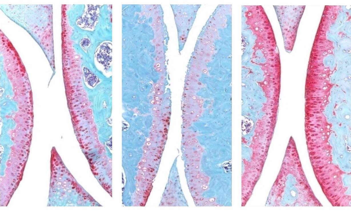 Revolutionary Anti-Aging Drug Restores Knee Cartilage, Potentially Eliminating Need for Knee Replacements