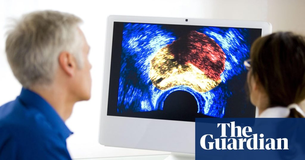 Study reveals prostate cancer is the most frequently diagnosed cancer in the UK