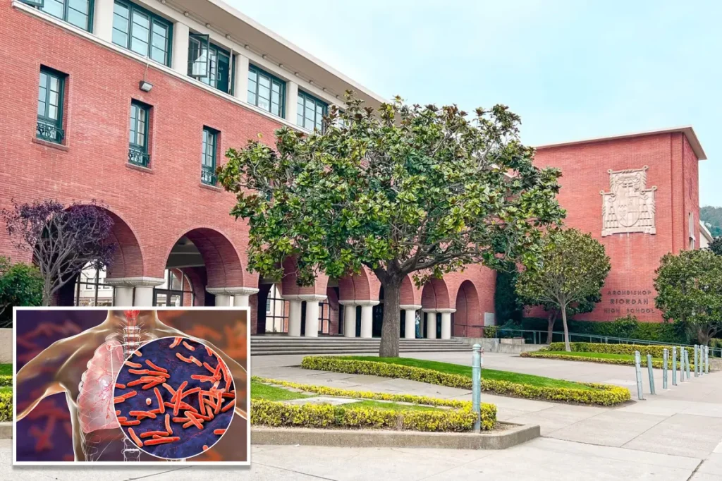 TB outbreak affects upscale private school in San Francisco