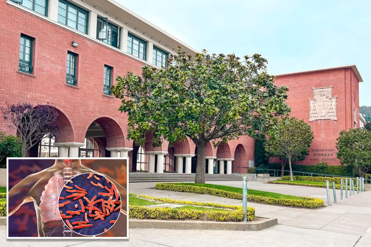 TB outbreak affects upscale private school in San Francisco