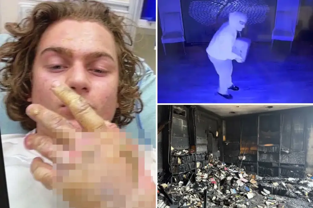 Teen charged with burning down Mississippi synagogue shared hospital selfie showing serious burns shortly after the incident