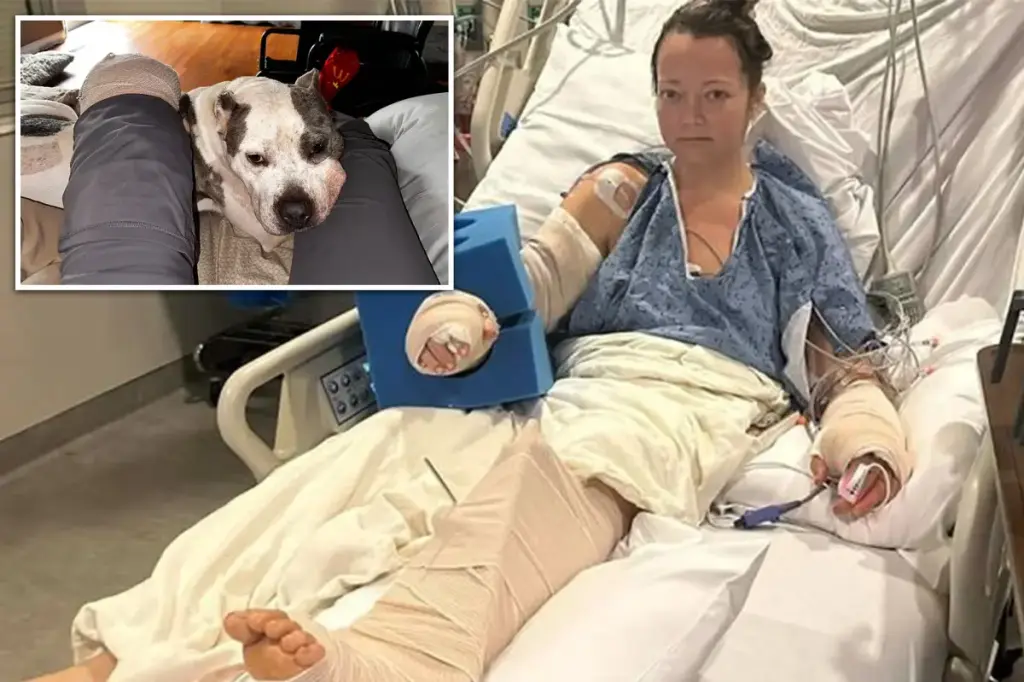 Tennessee mother attacked by pit bull had to amputate her leg that was severely injured.