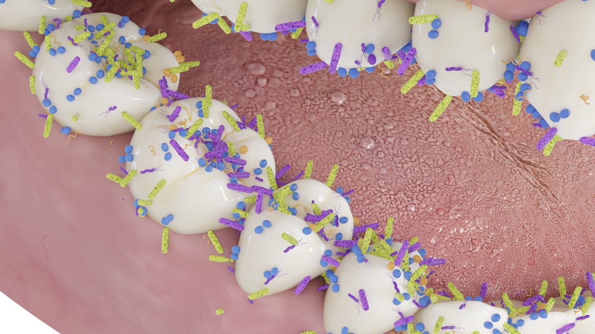 Strpping Tooth The Key to Stopping Tooth Decay Might Already Be In Your Mouth – Total News