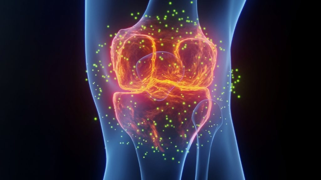 The Most Effective Treatment for Joint Pain May Surprise You, According to an Expert