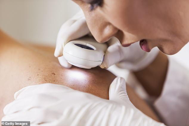 The surprising location where you might develop melanoma that isn't on your skin and isn't related to sun exposure.