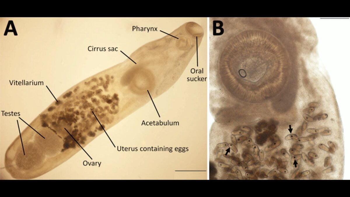 Woman Travels to the Galápagos and Ends Up with an Unusual Eye Parasite