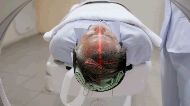 Brain condition increases dementia risk four times in older adults, research shows