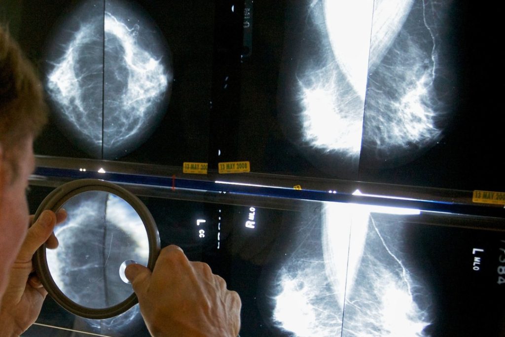 Cancer Patients Faced a Double Impact from the Pandemic