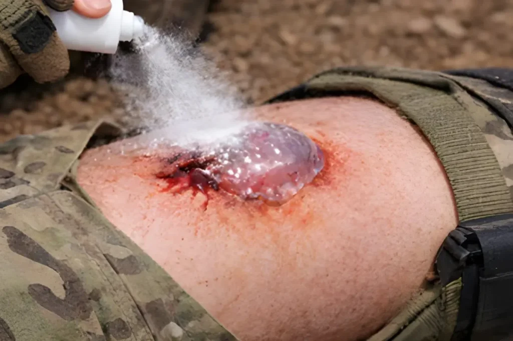 Korean researchers develop a spray that quickly stops bleeding and saves lives