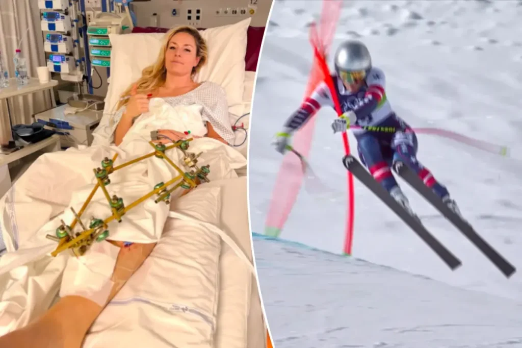 Lindsey Vonn shares news of her third surgery and posts first hospital photo following her crash at the 2026 Olympics