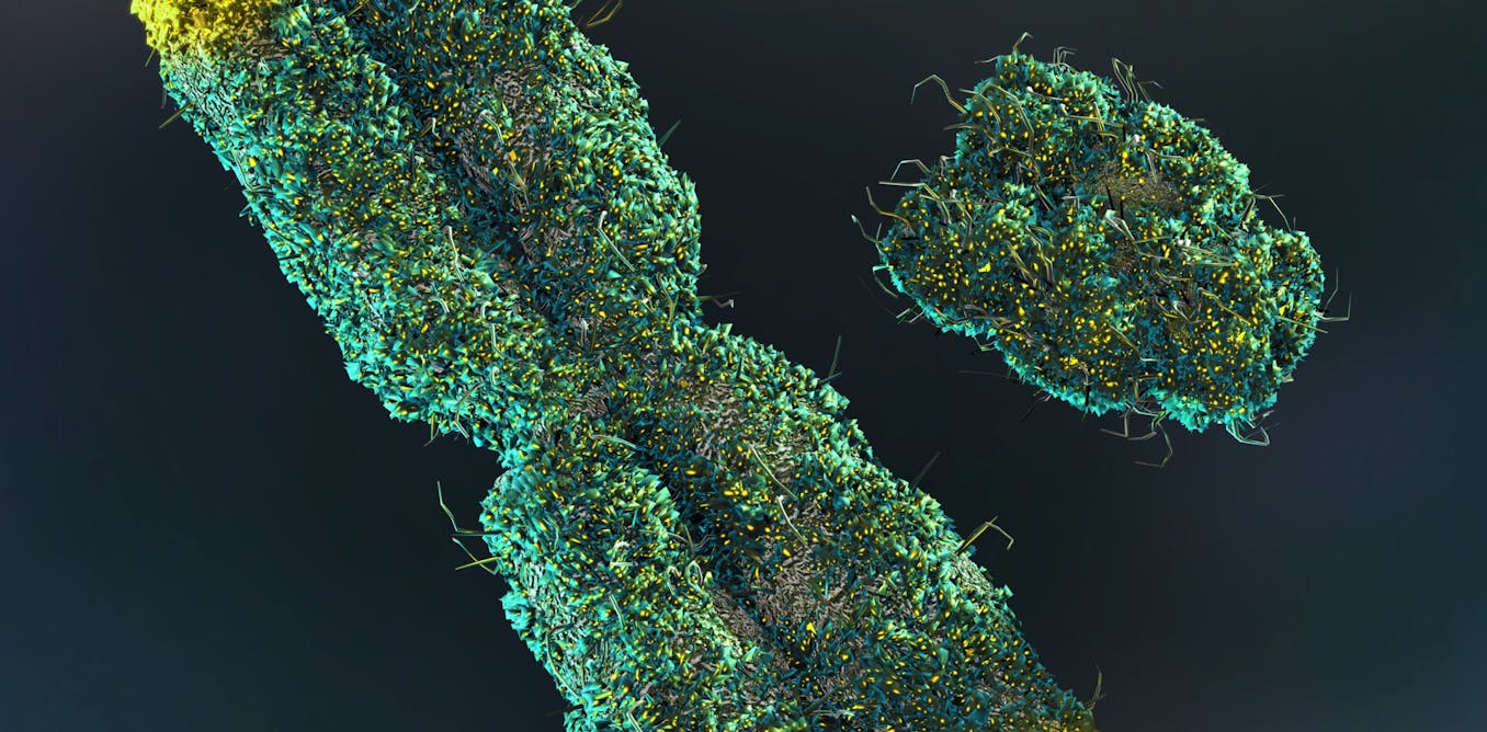 Men gradually lose their Y chromosome as they get older. Researchers believed it was insignificant, but we're now gaining more insights.