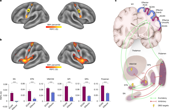 Parkinson’s disease as a disorder of body and mind coordination