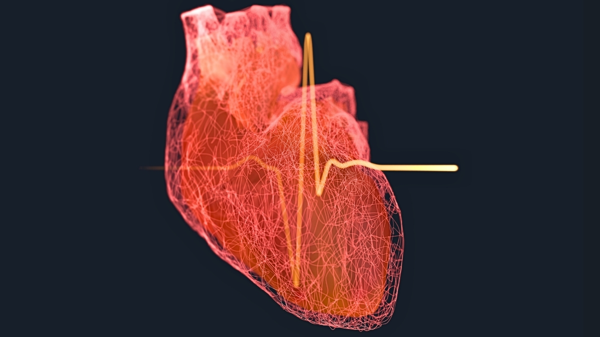 Research Shows a Shift When Men's Risk of Heart Attacks Increases