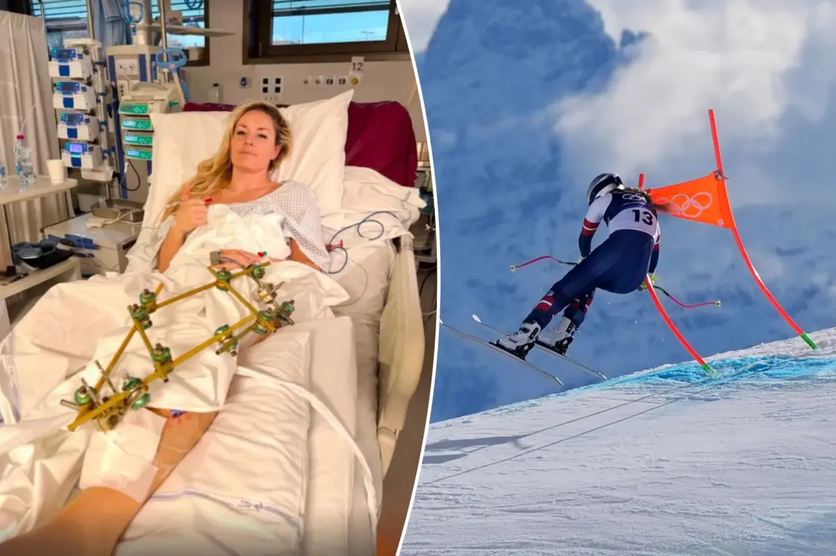Specialist expresses concerns about amputation after viewing Lindsey Vonn's hospital image.