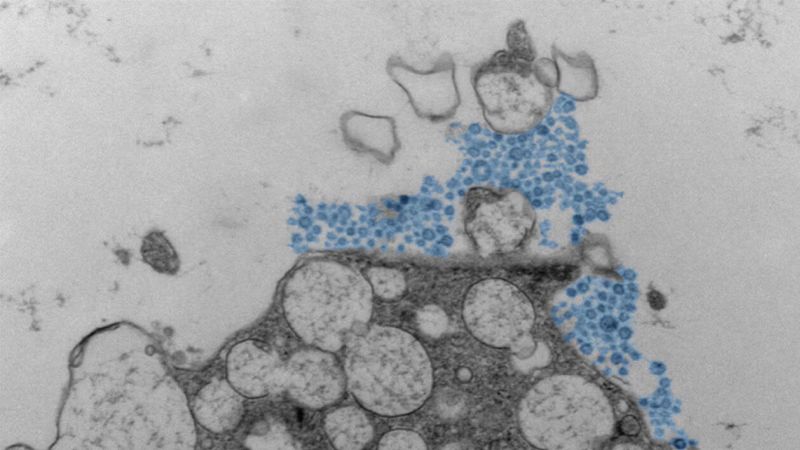 Why does the same cold virus affect some individuals more severely than others? The nose understands