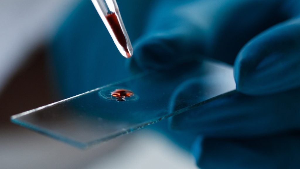 Basic Blood Test May Forecast Dementia Risk in Women Years Before Symptoms Appear