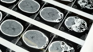 China creates a non-surgical ultrasound brain-computer connection.