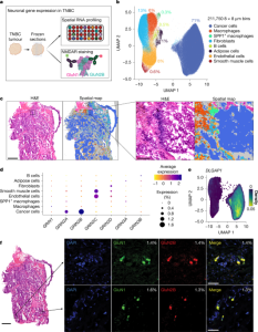 Ectopic NMDAR presence in cancer reveals inherited autoimmunity