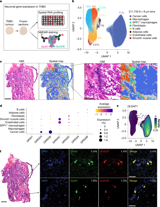 Ectopic NMDAR presence in cancer reveals inherited autoimmunity