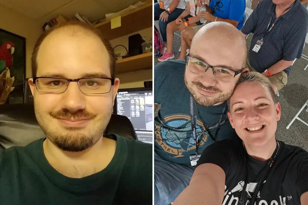 Epic Games job cuts leave employee with terminal brain cancer without coverage