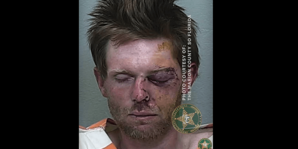 Man with an axe reportedly threatens car wash staff in Florida, but one victim fights back fiercely.