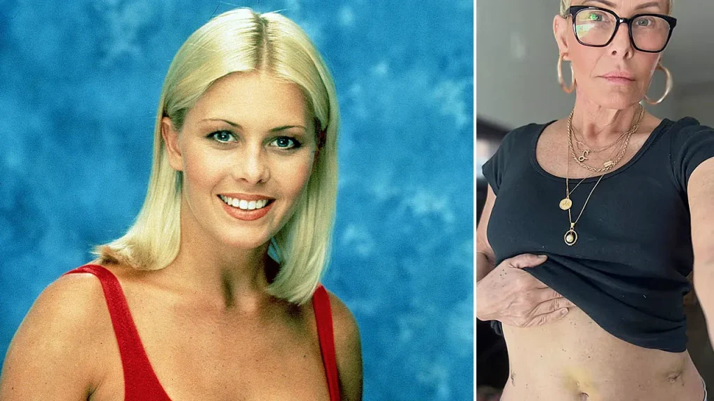 Nicole Eggert from 'Baywatch' shares new cancer symptoms and undergoes hysterectomy