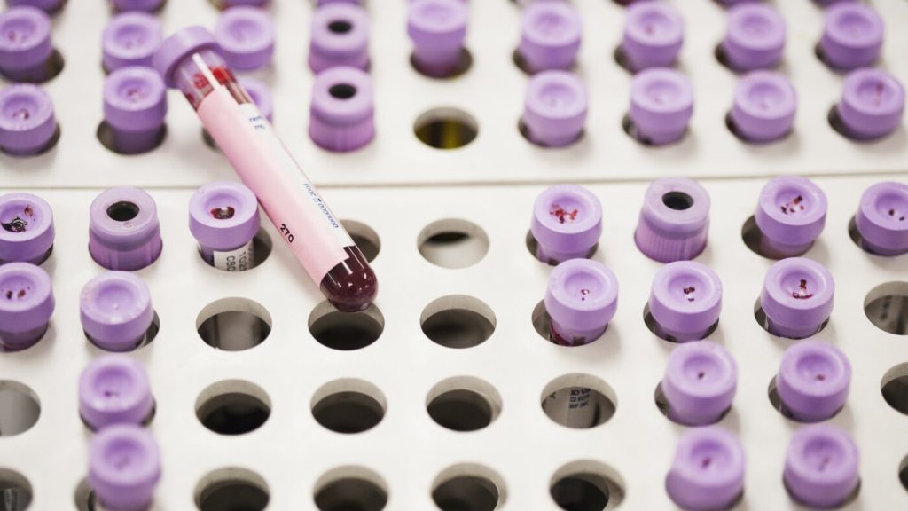 Revised guidelines provide a new strategy for handling high cholesterol