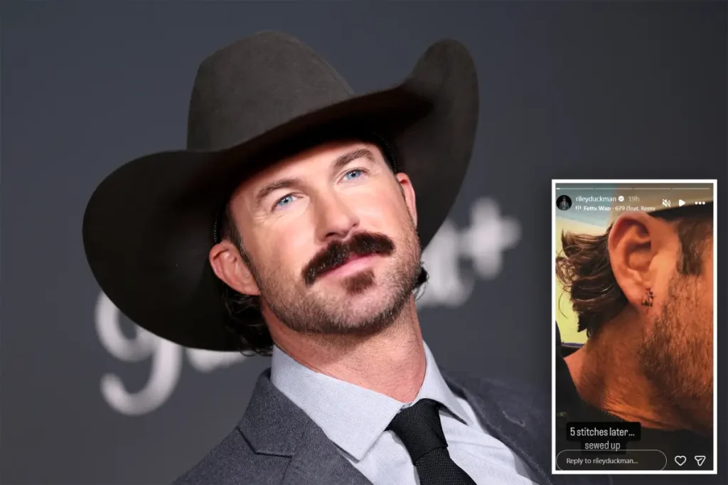 Riley Green injured after fan throws phone at him during concert performance