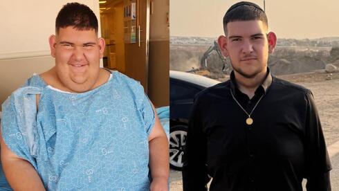 Teen sheds 113 kg after battling obesity