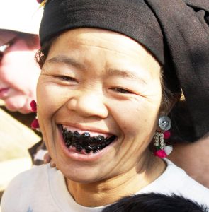 The beauty trend of tooth blackening in Vietnam started 2,000 years ago.