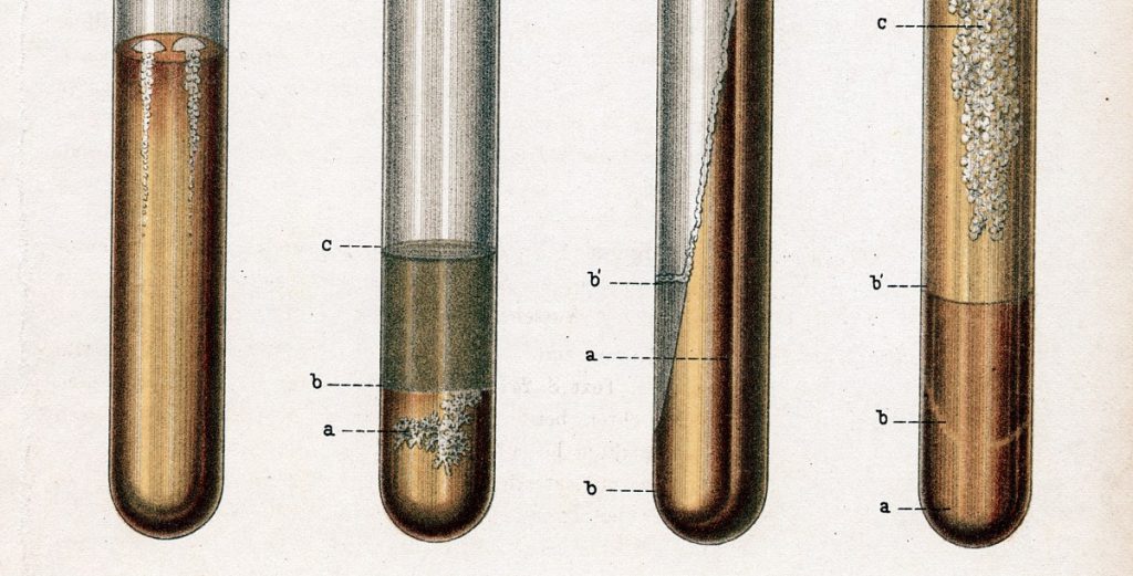 The most lethal infectious disease is increasing in the US.