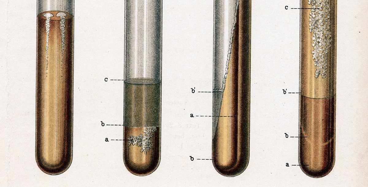 The most lethal infectious disease is increasing in the US.
