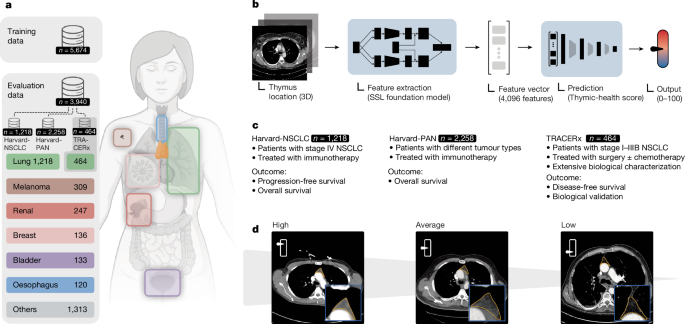 The relationship between thymus health and immunotherapy results in cancer patients