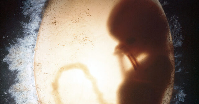 Wyoming Governor Approves Law Limiting Abortion After Heartbeat Is Found