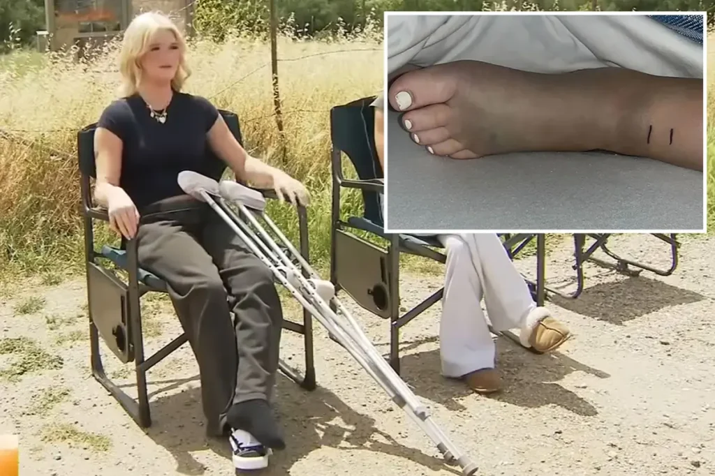 14-year-old girl from Southern California shares her terrible injuries after a rattlesnake attack: 'I lost my hearing'
